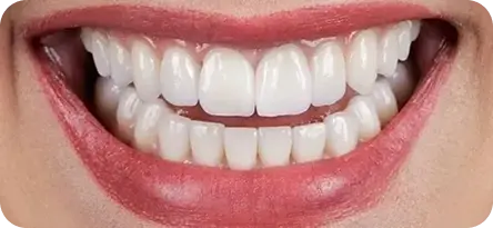 What is smile makeover