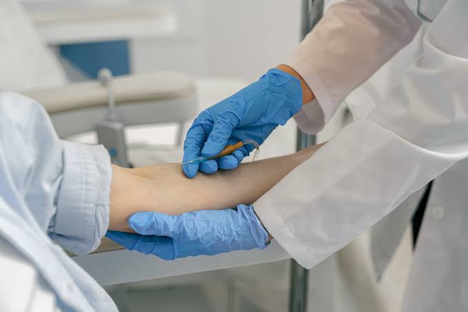 types of sedation dentistry: IV Sedation